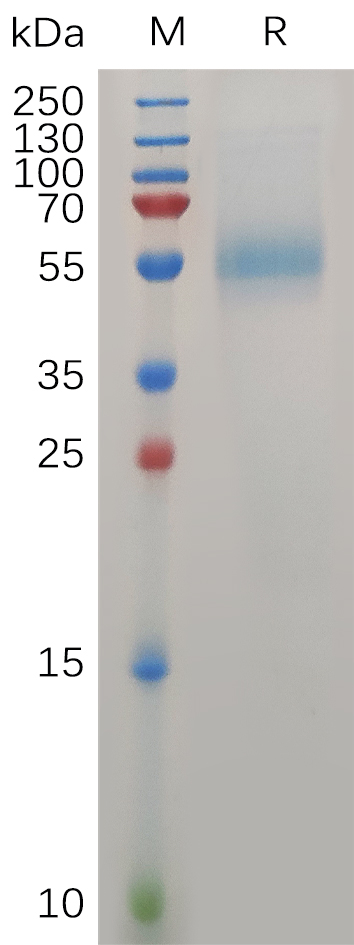 Human Zp Protein His Tag