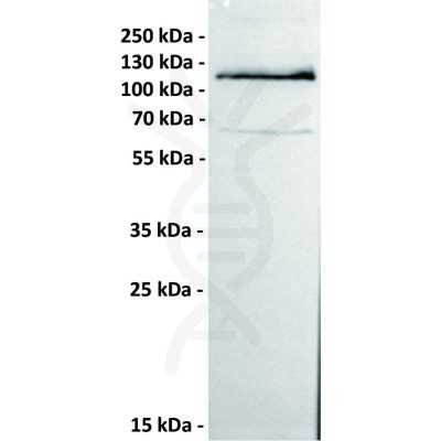 antibody-dmc100228 ror1 wb1