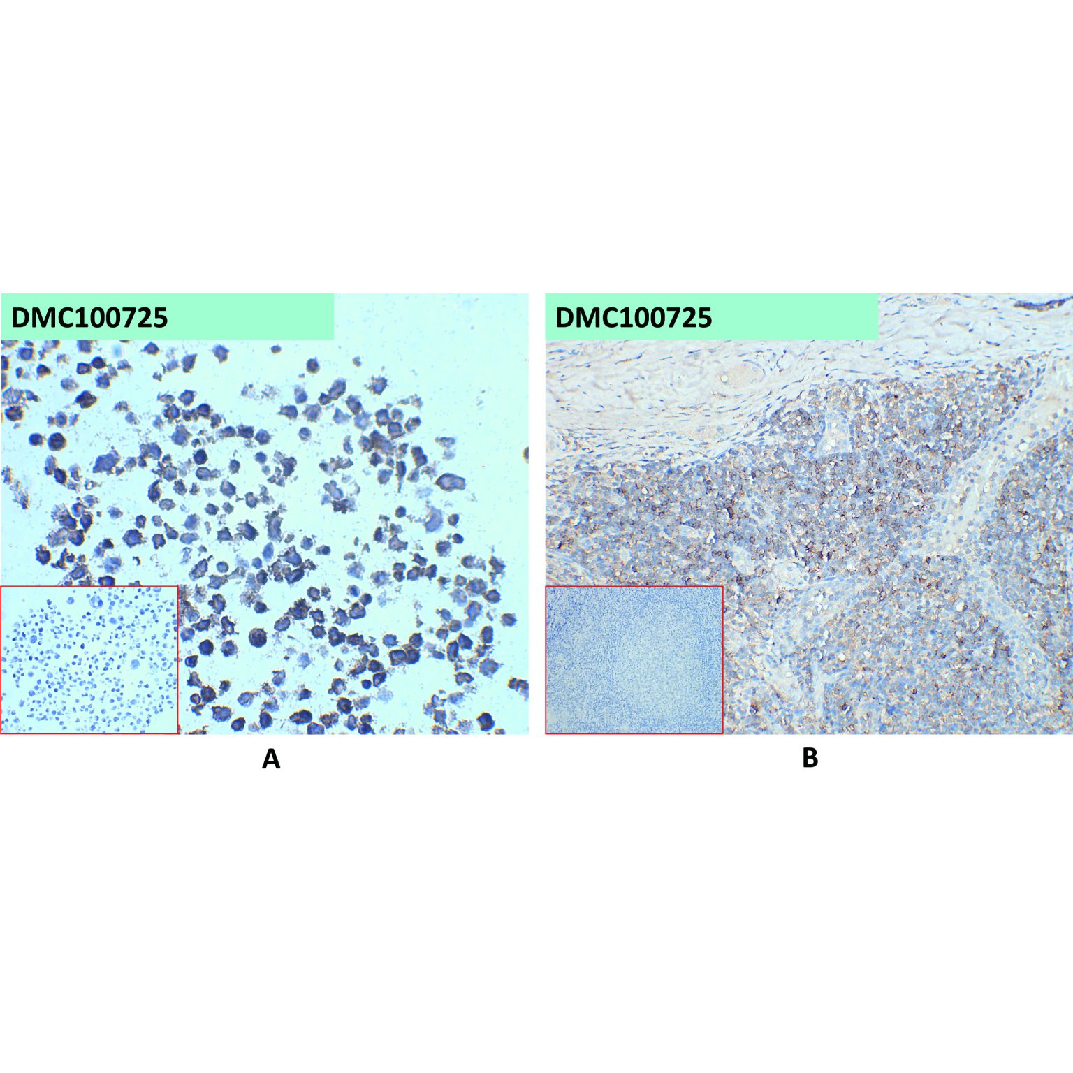 Anti-CD45 antibody(7E1), IgG1 Chimeric mAb - 专注肿瘤免疫