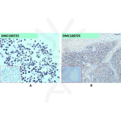 antibody-dmc100725 cd45 ihc1