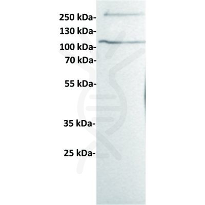 antibody-dme100433 her3 wb1