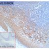 antibody-dme101059 her3 ihc1