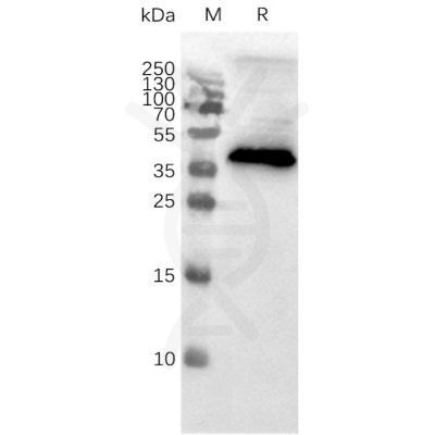 page-FLP100001 CCR8 Fig.2 SDS PAGE 1