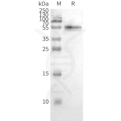 page-FLP100028 CCR2 Fig.3 SDS PAGE 2