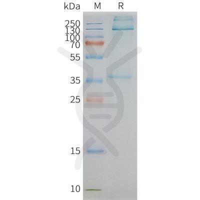 page-FLP100055 ADGRE1 Fig.2 SDS PAGE 1