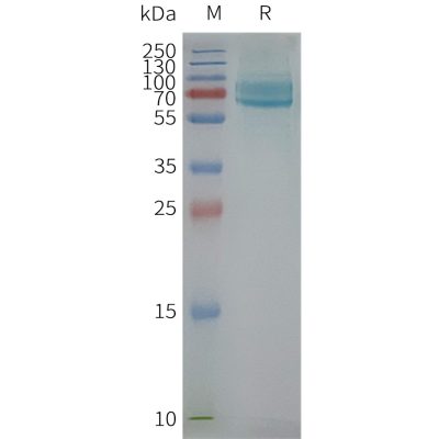 page-FLP100065 CD39 Fig.2 SDS PAGE 1