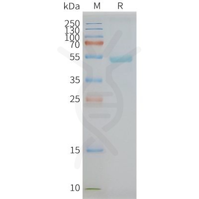 page-FLP100069 GPR77 Fig.2 SDS PAGE 1