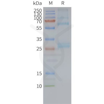 page-FLP100104 ADGRG1 Fig.2 SDS PAGE 1