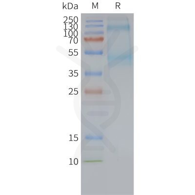 page-FLP100107 ADGRG2 Fig.2 SDS PAGE 1