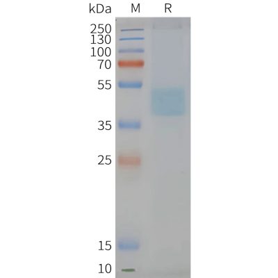 page-FLP100124 CXCR6 Fig.2 SDS PAGE 1