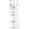 page-FLP100128 TRPV1 Fig.2 SDS PAGE 1