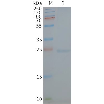 page-FLP100142 CAV1 Fig.2 SDS PAGE 1