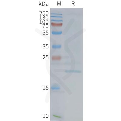 page-FLP100149 EMP2 Fig.2 SDS PAGE 1