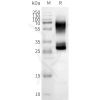 page-FLP100151 OR2B3 Fig.2 SDS PAGE 1