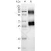 page-FLP100153 OR8U8 Fig.2 SDS PAGE 1