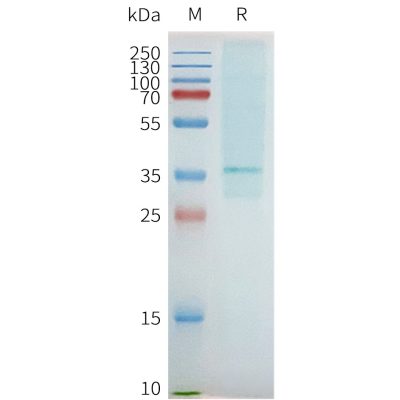 page-flp100093 adora2b sp1