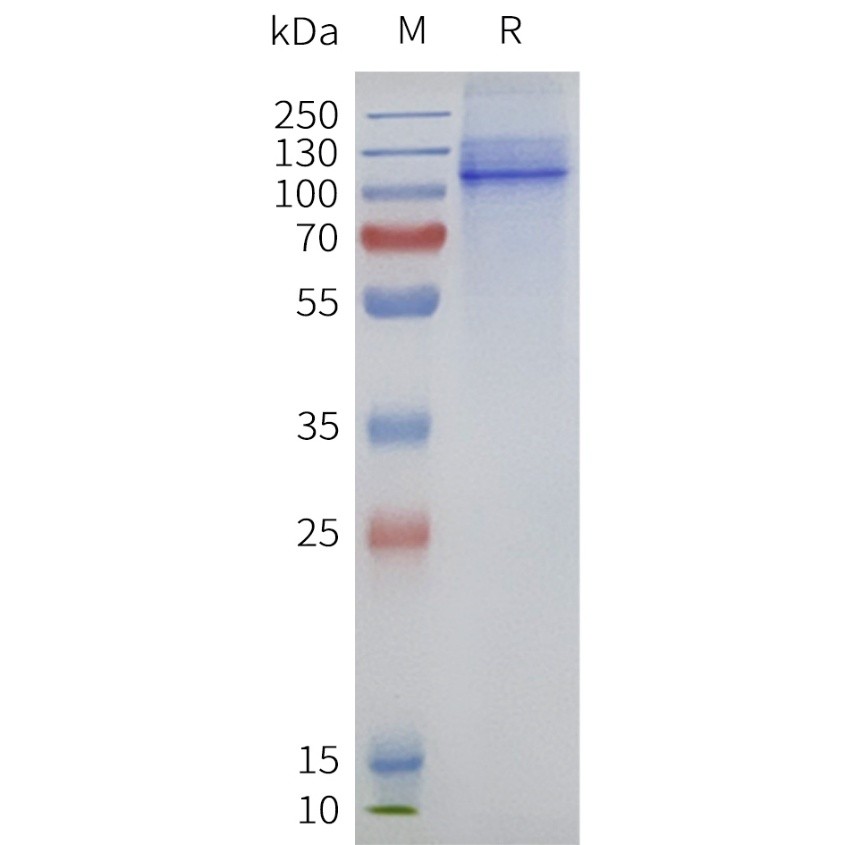 flp120128-trpv1-strep-sp1.jpg