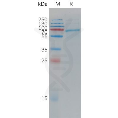 sp-PME C100012 ADAM9 Fig.1 SDS PAGE 1