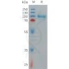 sp-PME C100014 CD93 Fig.1 SDS PAGE 1