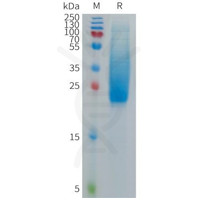 sp-PME C100015 IL18BP Fig.1 SDS PAGE 1