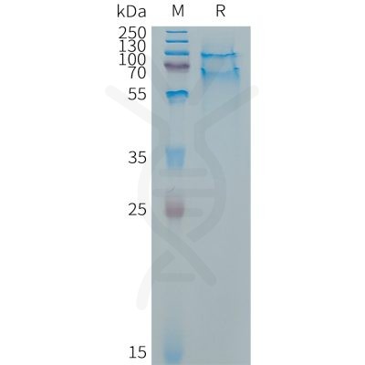 sp-PME C100016 SELPLG Fig.1 SDS PAGE 1