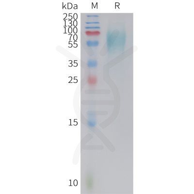 sp-PME C100020 5T4 Fig.1 SDS PAGE 1