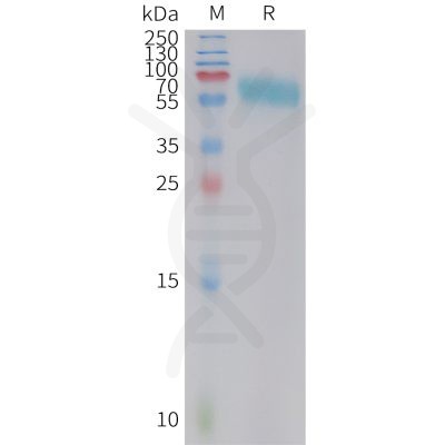 sp-PME C100023 4 1BB Fig.1 SDS PAGE 1