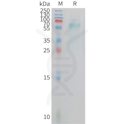 sp-PME C100024 TREM2 Fig.1 SDS PAGE 1