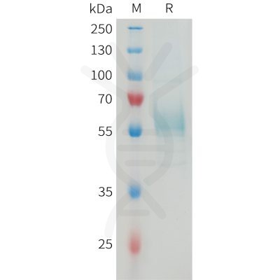 sp-PME M100080 TREM2 Fig.1 SDS PAGE 1