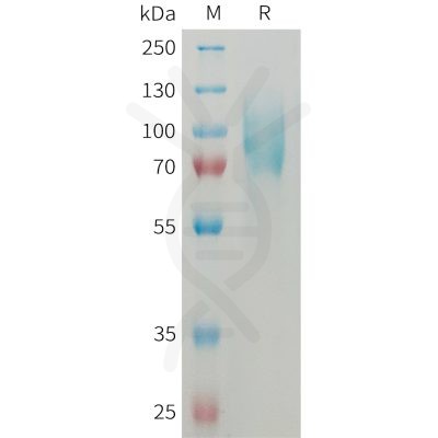 sp-PME M100082 ICAM1 Fig.1 SDS PAGE 1