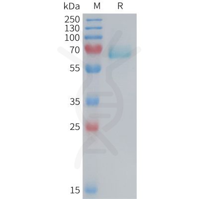 sp-PME M100084 EPHA2 Fig.1 SDS PAGE 1