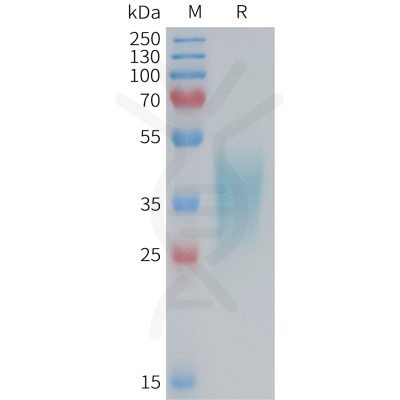 sp-PME M100086 TNFRSF1B Fig.1 SDS PAGE 1