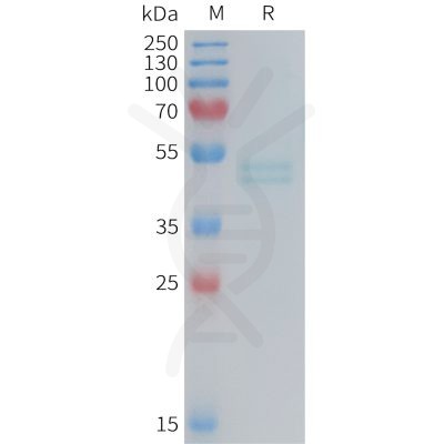 sp-PME M100088 IL11RA Fig.1 SDS PAGE 1