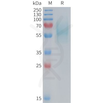 sp-PME M100089 5T4 Fig.1 SDS PAGE 1