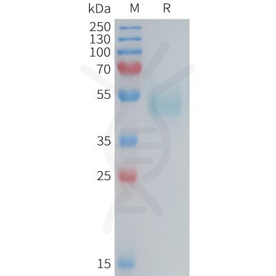 sp-PME M100090 TSLP Fig.1 SDS PAGE 1