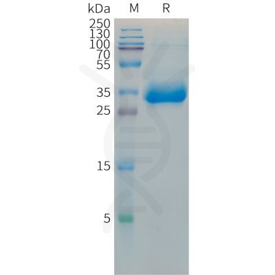 sp-PME M100091 HistoneH1.2 Fig.1 SDS PAGE 1