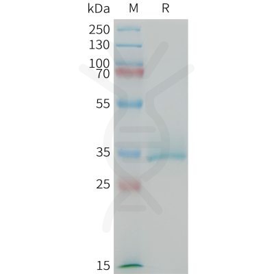 sp-PME M100093 CGRP Fig.1 SDS PAGE 1