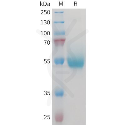 sp-PME M100095 CD70 Fig.1 SDS PAGE 1