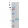 sp-PME M100096 IGF1 Fig.1 SDS PAGE 1