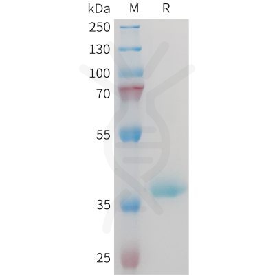 sp-PME M100096 IGF1 Fig.1 SDS PAGE 1