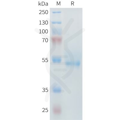 sp-PME M100097 ROR2 Fig.1 SDS PAGE 1