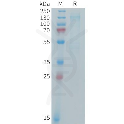 sp-PME M100101 IGF 1R Fig.1 SDS PAGE 1