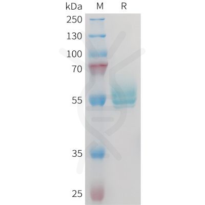 sp-PME M100102 TNFSF15 Fig.1 SDS PAGE 1