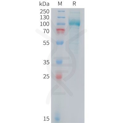 sp-PME M100103 PSMA Fig.1 SDS PAGE 1