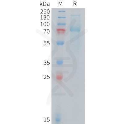 sp-PME M100104 TFRC Fig.1 SDS PAGE 1