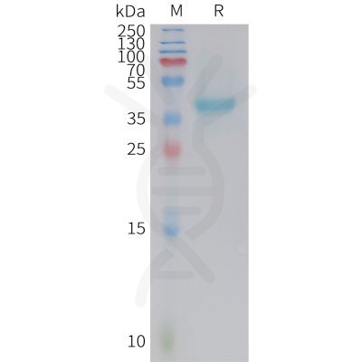 sp-PME M100108 NECTIN 4 Fig.1 SDS PAGE 1