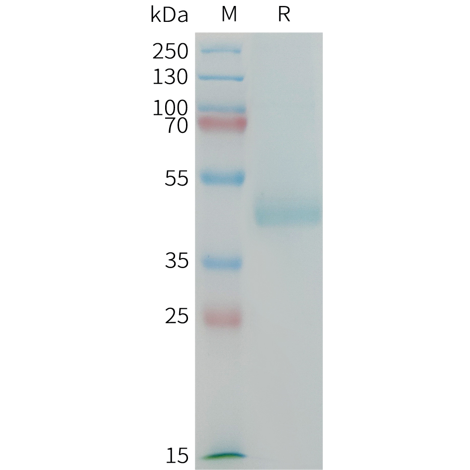 PME100199-CDH17-Fig.1-SDS-PAGE-1.jpg