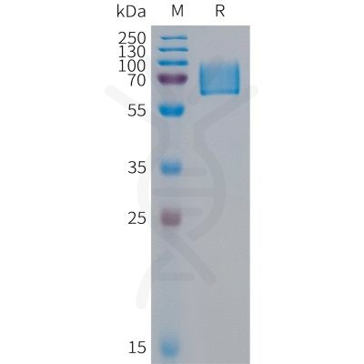 sp-PME100317 KIR2DL1 Fig.1 SDS PAGE 1