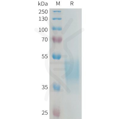 sp-PME100319 KIR2DL3 Fig.1 SDS PAGE 1