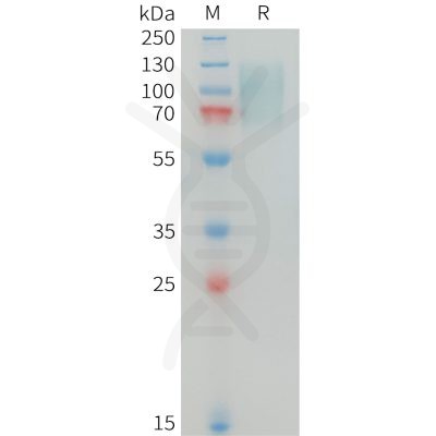 sp-PME100344 MERTK Fig.1 SDS PAGE 1 1